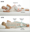 Postura™ Knee Alignment Pillow